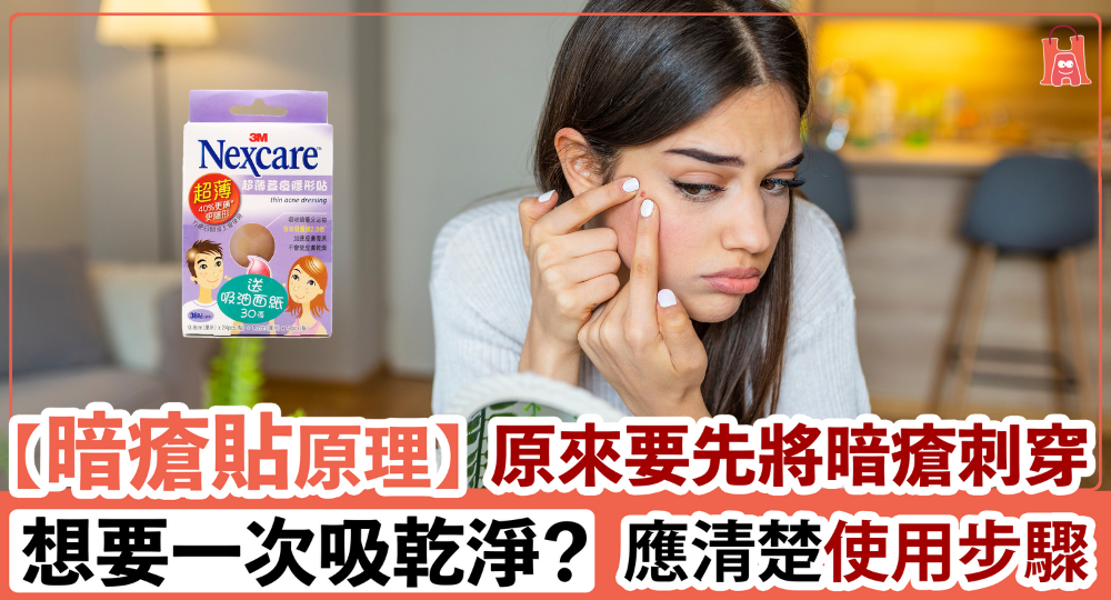 【暗瘡貼原理】應清楚使用步驟|要先將暗瘡刺穿嗎?