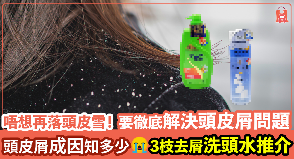 【不要頭油】頭皮屑都有分類?|去屑洗頭水推介