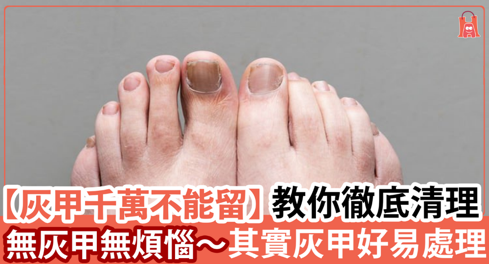 【無灰甲無煩惱】原來灰甲好易處理?灰妥甲幫到手