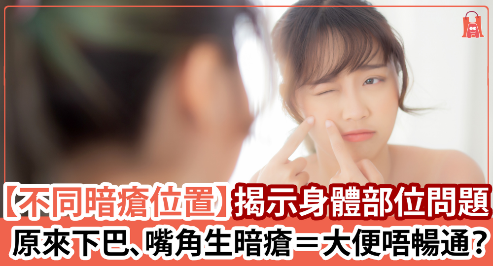 【長暗瘡長知識】不同暗瘡位置 揭示身體部位問題!