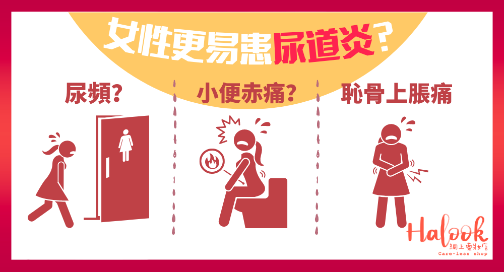 【女性更易患尿道炎?】注意這些症狀!避免患尿道炎方法