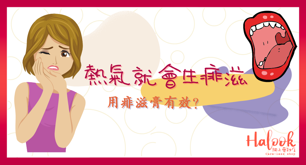 【熱氣就會生痱滋?】用痱滋膏有效?
