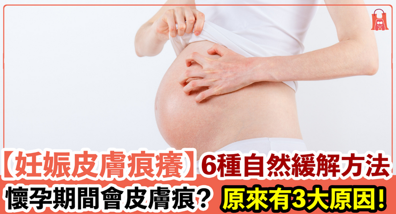 【妊娠皮膚痕癢】懷孕期間為什麼會皮膚痕？6 種自然緩解方法